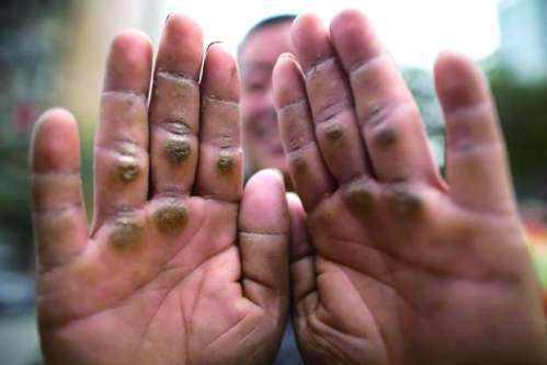 健身手套能防止手掌结老茧吗_健身手套防起茧_健身手套老茧