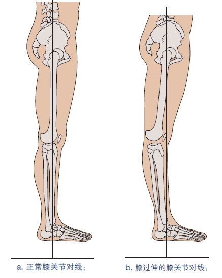 髋关节训练椅说明书_髋关节训练椅的用途_髋关节训练椅