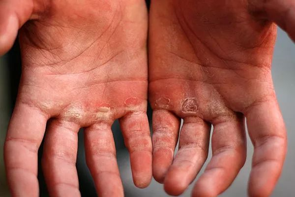 手套健身防滑吗_健身防滑手套_锻炼用防滑手套