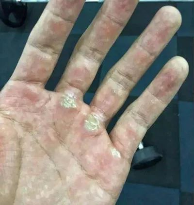 健身手套护腕_手套健身护腕的作用_带护腕的健身手套