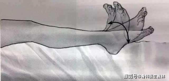 髋关节训练器的适应症_髋关节坐姿_髋关节训练椅