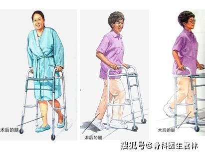 髋关节训练椅_髋关节坐姿_髋关节训练器的适应症