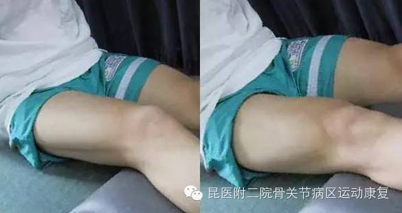 股四头肌训练椅安装步骤_股四头肌训练椅_股四头肌训练椅注意事项