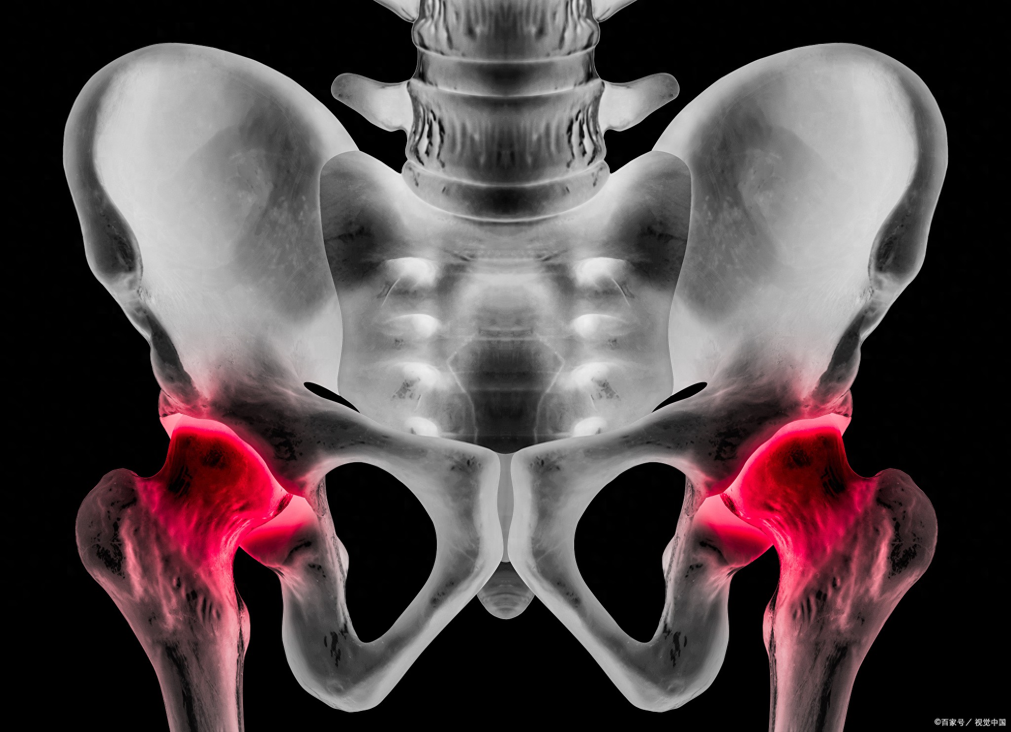 开yun体育app入口登录 髋关节外侧痛，小心是关节受损发炎！按压5点预防髋关节痛
