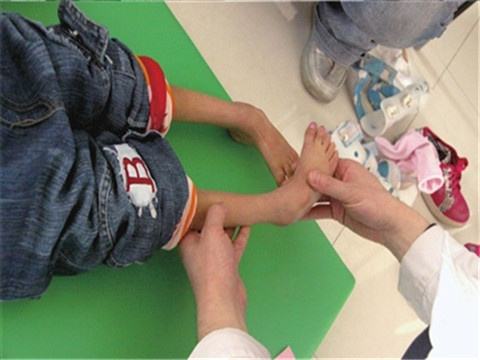 髋关节训练器_髋关节训练椅_髋关节训练器的适应症