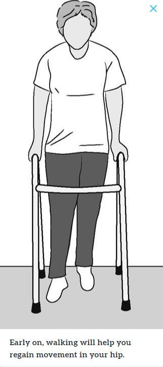 髋关节训练器的适应症_髋关节训练椅_髋关节训练椅说明书