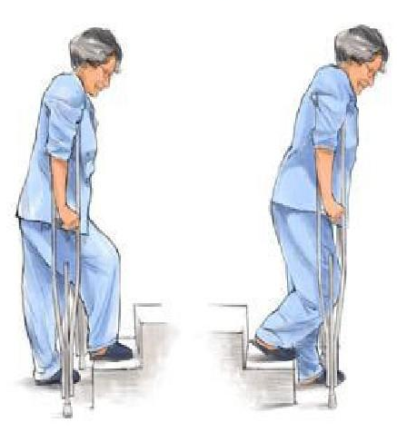 髋关节训练椅_髋关节训练器的适应症_髋关节训练椅的用途