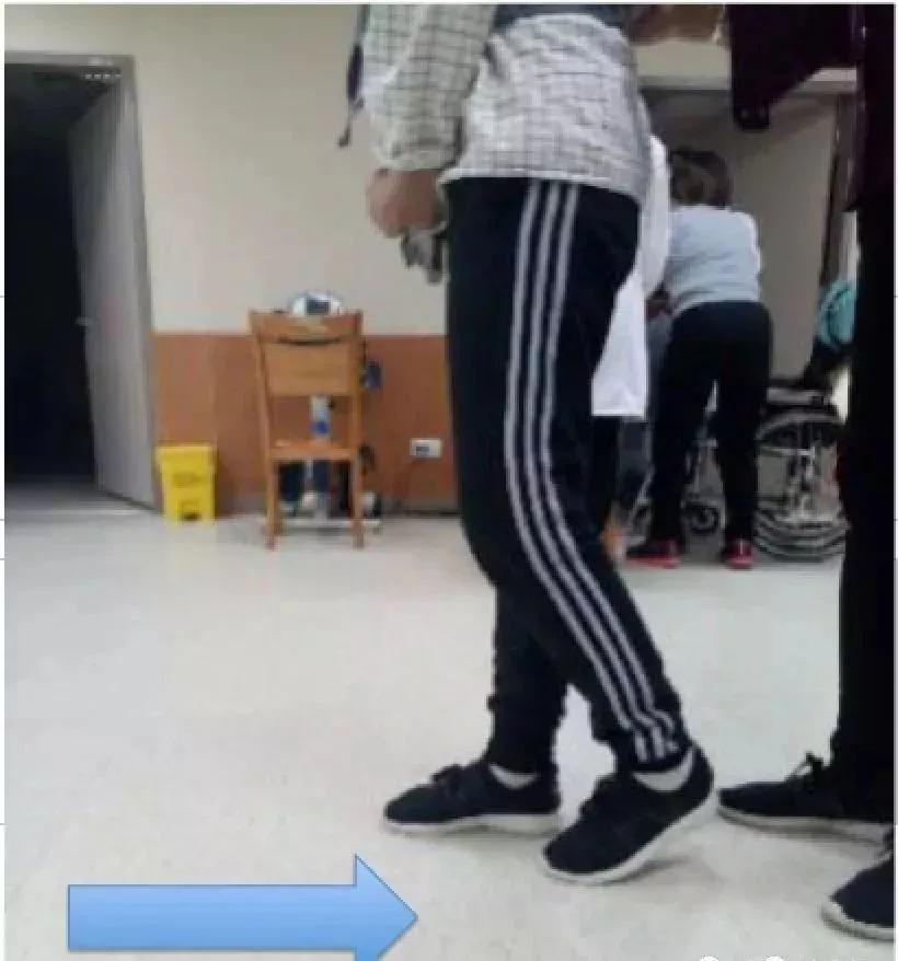 髋关节训练椅_髋关节训练器的适应症_髋关节坐姿