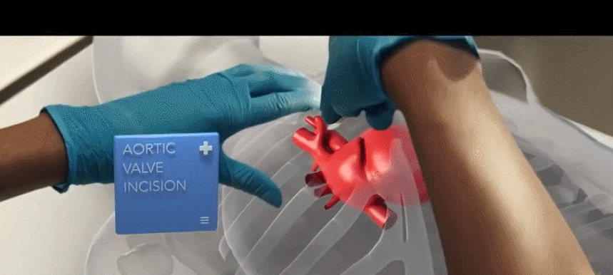 手套健身腕带怎么戴_带护腕的健身手套_健身腕带还是手套