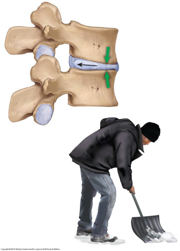 髋关节训练器的适应症_髋关节坐姿_髋关节训练椅