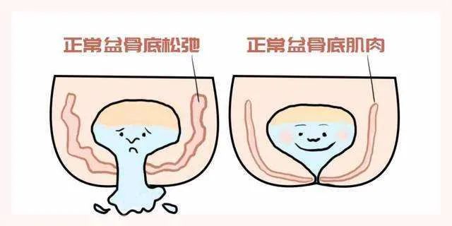 髋关节训练椅说明书_髋关节训练器的适应症_髋关节训练椅