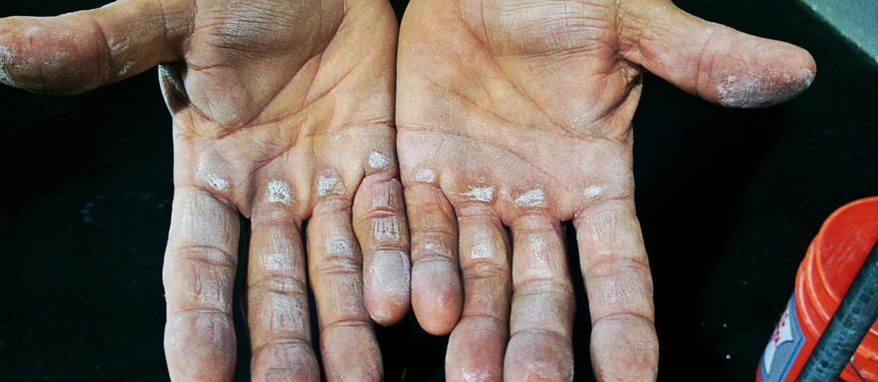 开yun体育app官方下载入口 健身留下的老茧，很酷，也很苦