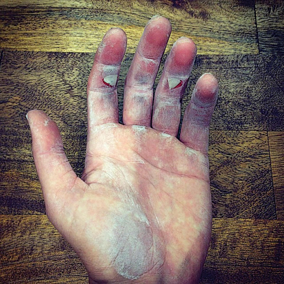 健身手套老茧_手套健身老茧怎么去除_手套健身老茧怎么去掉