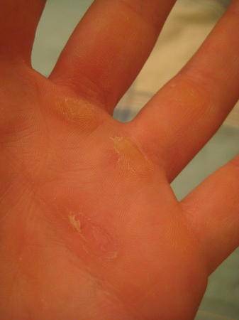 健身手套老茧_手套健身老茧怎么去掉_手套健身老茧怎么去除