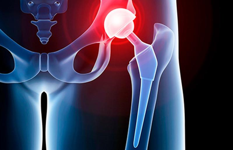 髋关节训练器的适应症_髋关节训练椅说明书_髋关节训练椅