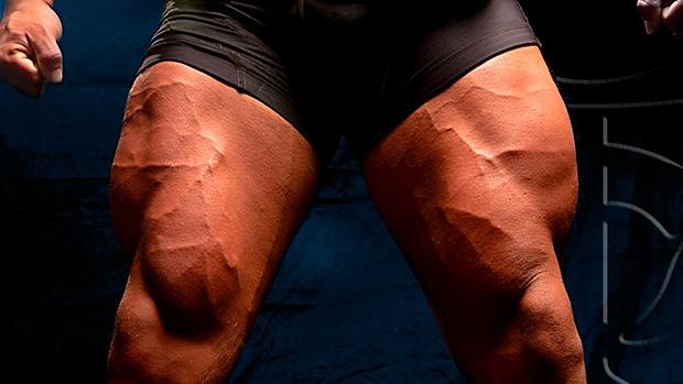 开yun官网入口登录APP下载 10位专家给出的股四头肌最佳训练方式-2