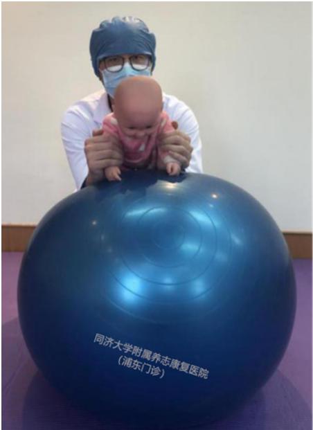 kaiyun体育 科普|Bobath球在康复训练中的使用（第三部分） —肩、髋、膝的伸展及平衡反应