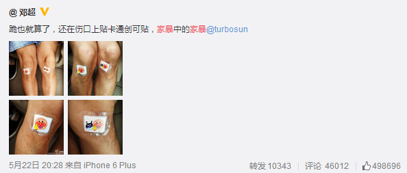 健身手套需要护腕吗_健身手套护腕什么牌子好_手套健身护腕需要戴多久