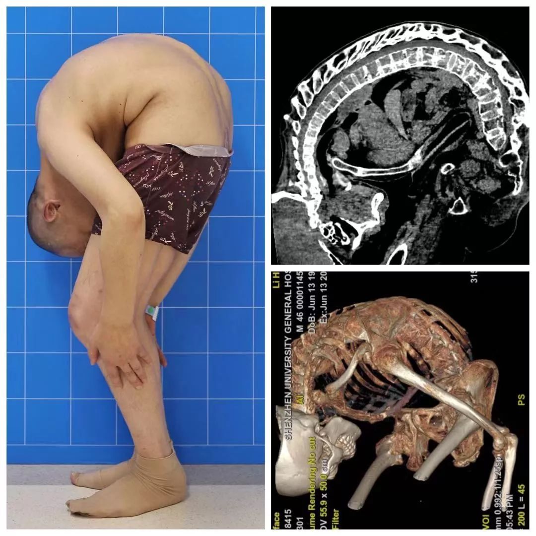 kaiyun官方网app下载app 为了一个人的直立行走