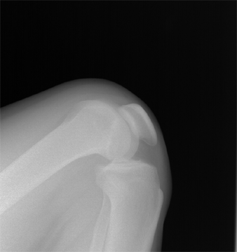 股四头肌训练椅_股四头肌训练椅安装步骤_股四头肌训练椅安装视频