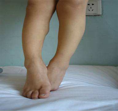 开yun体育官网入口登录体育 【康复指导】脑瘫儿童出现剪刀步怎么办？