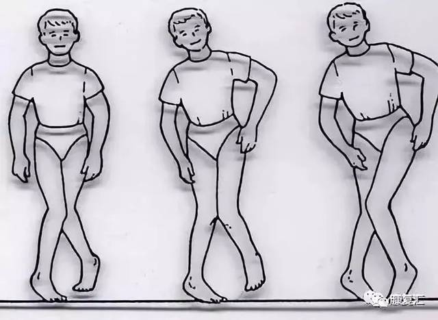 髋关节训练器_髋关节训练椅_髋关节坐姿