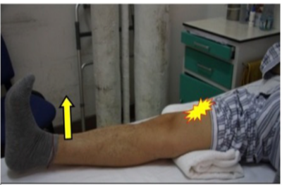 髋关节坐姿_髋关节训练椅说明书_髋关节训练椅