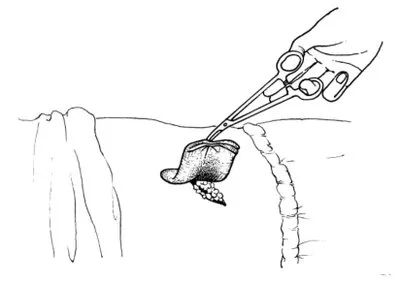 髋关节训练椅说明书_髋关节训练椅_髋关节坐姿