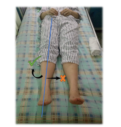 髋关节坐姿_髋关节训练椅说明书_髋关节训练椅