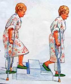 髋关节训练椅_髋关节训练器使用说明_髋关节训练椅的用途