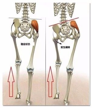 髋关节坐姿_髋关节训练椅_髋关节训练器的适应症
