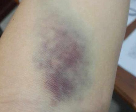 综合训练器怎么样贴吧_筋膜枪选购指南_筋膜枪是智商税吗