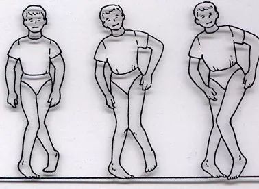 开yun体育app官方下载入口 康复方案 | 各类型小儿脑瘫的康复训练方法汇总