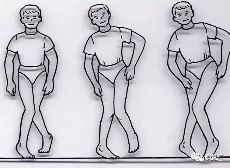 髋关节训练椅_髋关节坐姿_髋关节训练器的适应症