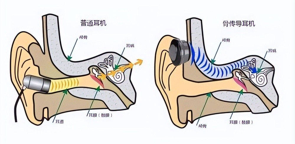 什么牌子的跑步机质量好_运动耳机选购指南_运动耳机佩戴稳定性