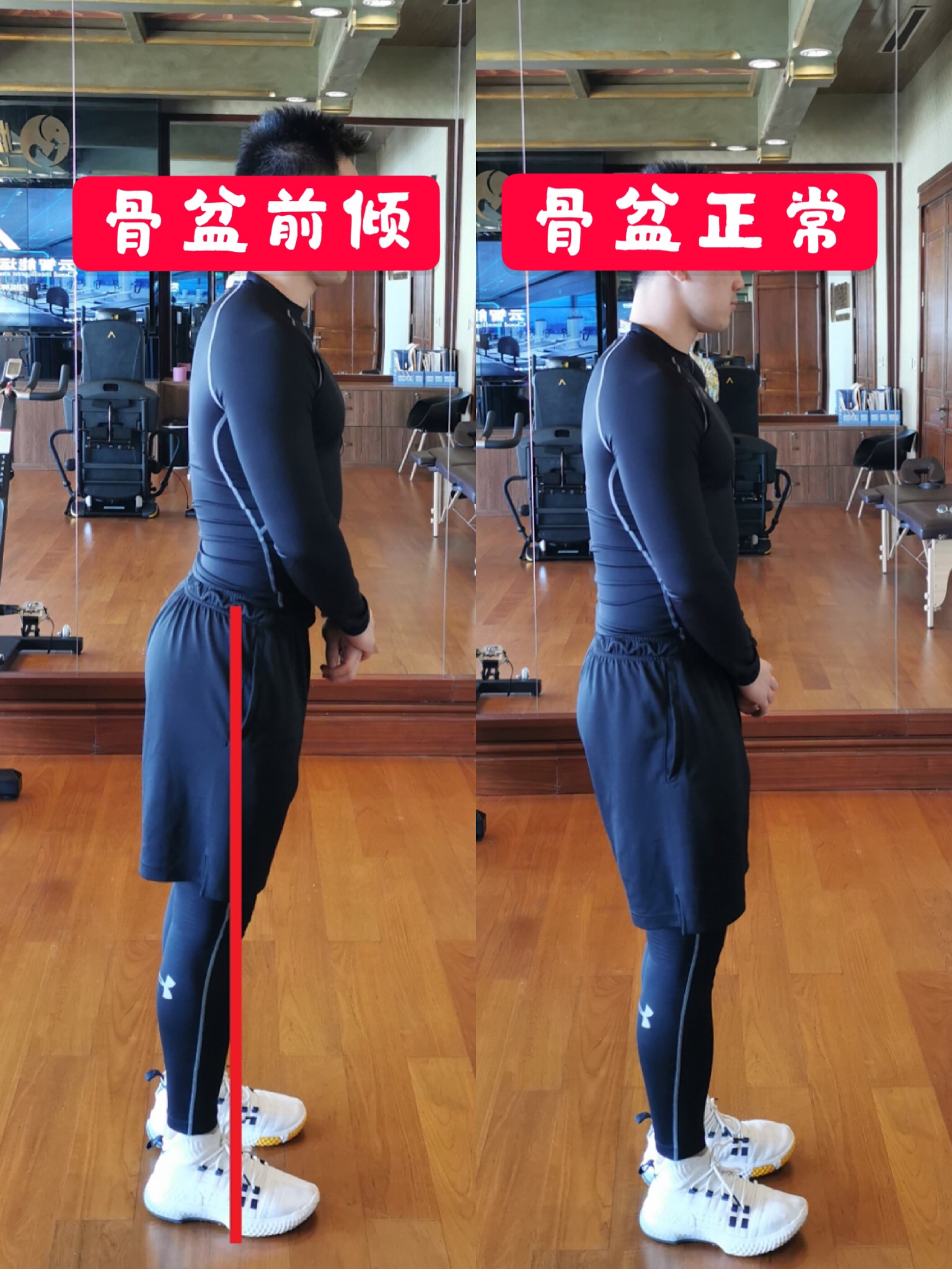 骨盆前倾改善方法_骨盆前倾原因_髋关节训练椅