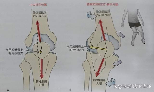 股四头肌训练椅子_股四头肌训练椅_股四头肌训练椅使用方法