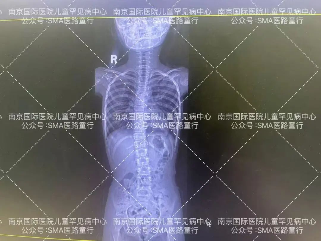 感统训练单腿椅_感统训练坐独角椅_感统课独脚凳的目的