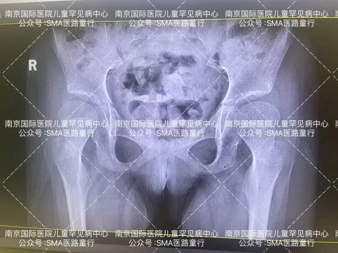 感统课独脚凳的目的_感统训练坐独角椅_感统训练单腿椅