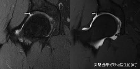 髋关节训练椅说明书_髋关节训练椅的用途_髋关节训练椅