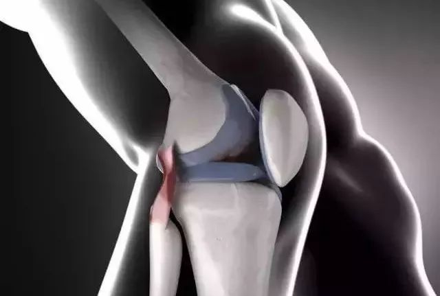 yy漫画画免费读漫画下拉式在线观看 【运动康复】骨性关节炎康复训练