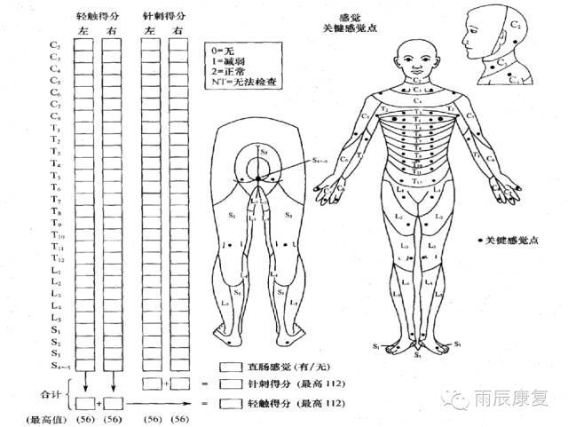 髋关节训练器的适应症_髋关节训练椅_髋关节训练椅的用途