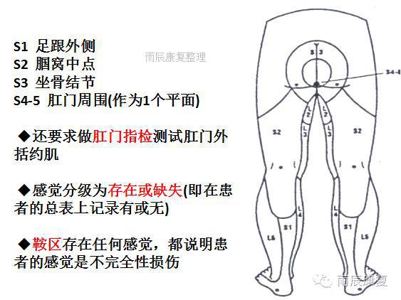 髋关节训练椅_髋关节训练椅的用途_髋关节训练器的适应症