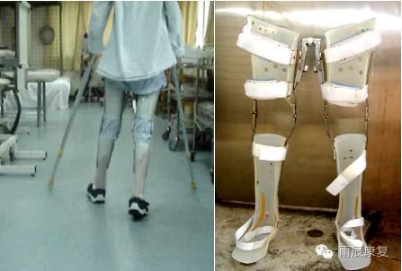 髋关节训练器的适应症_髋关节训练椅_髋关节训练椅的用途