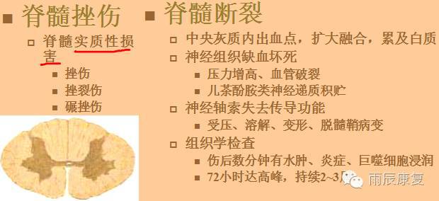 髋关节训练椅_髋关节训练椅的用途_髋关节训练器的适应症