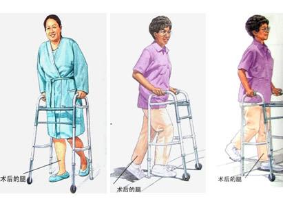 髋关节坐姿_髋关节训练椅_髋关节训练器的适应症