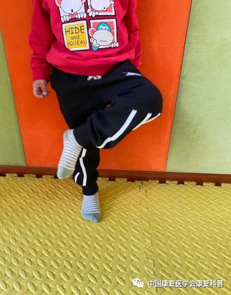 儿童感觉统合游戏大全_感觉统合训练方法_感统训练单腿椅