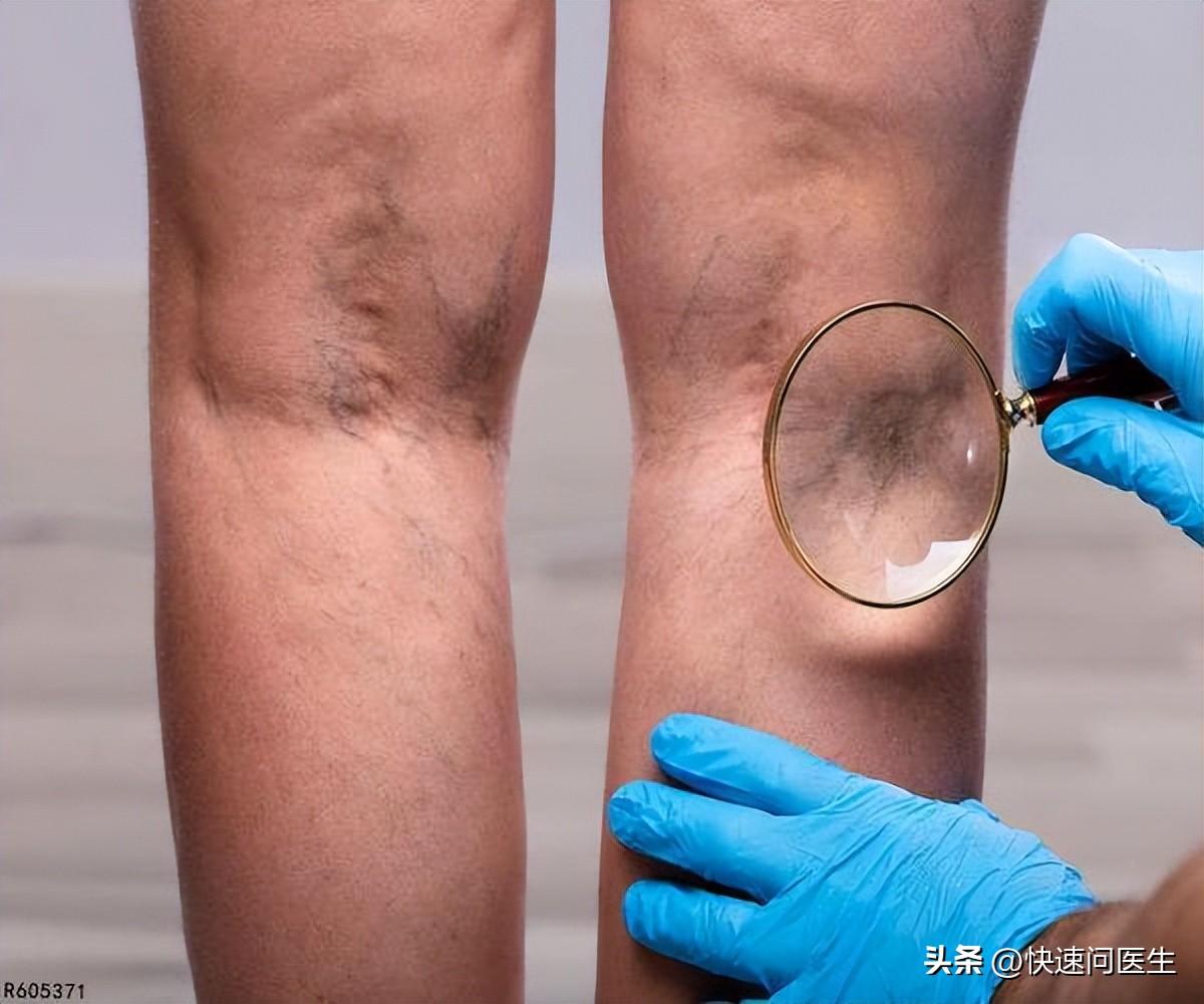 髋关节训练椅的用途_髋关节训练器使用说明_髋关节训练椅