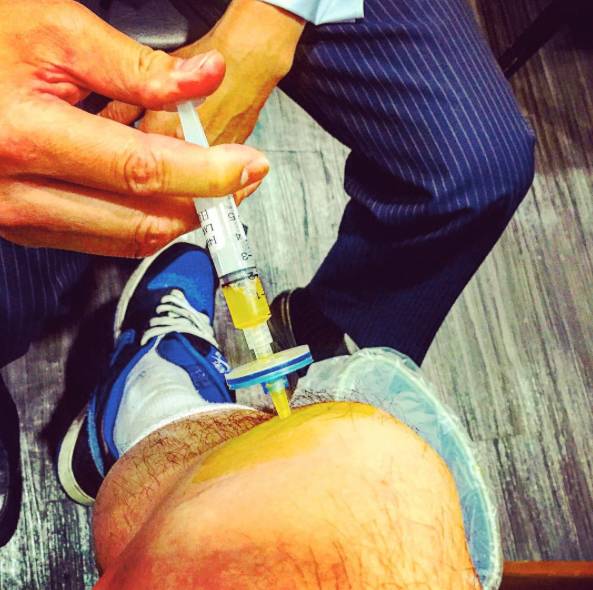 反重力跑步机原理_反重力跑步鞋_反重力跑台原理