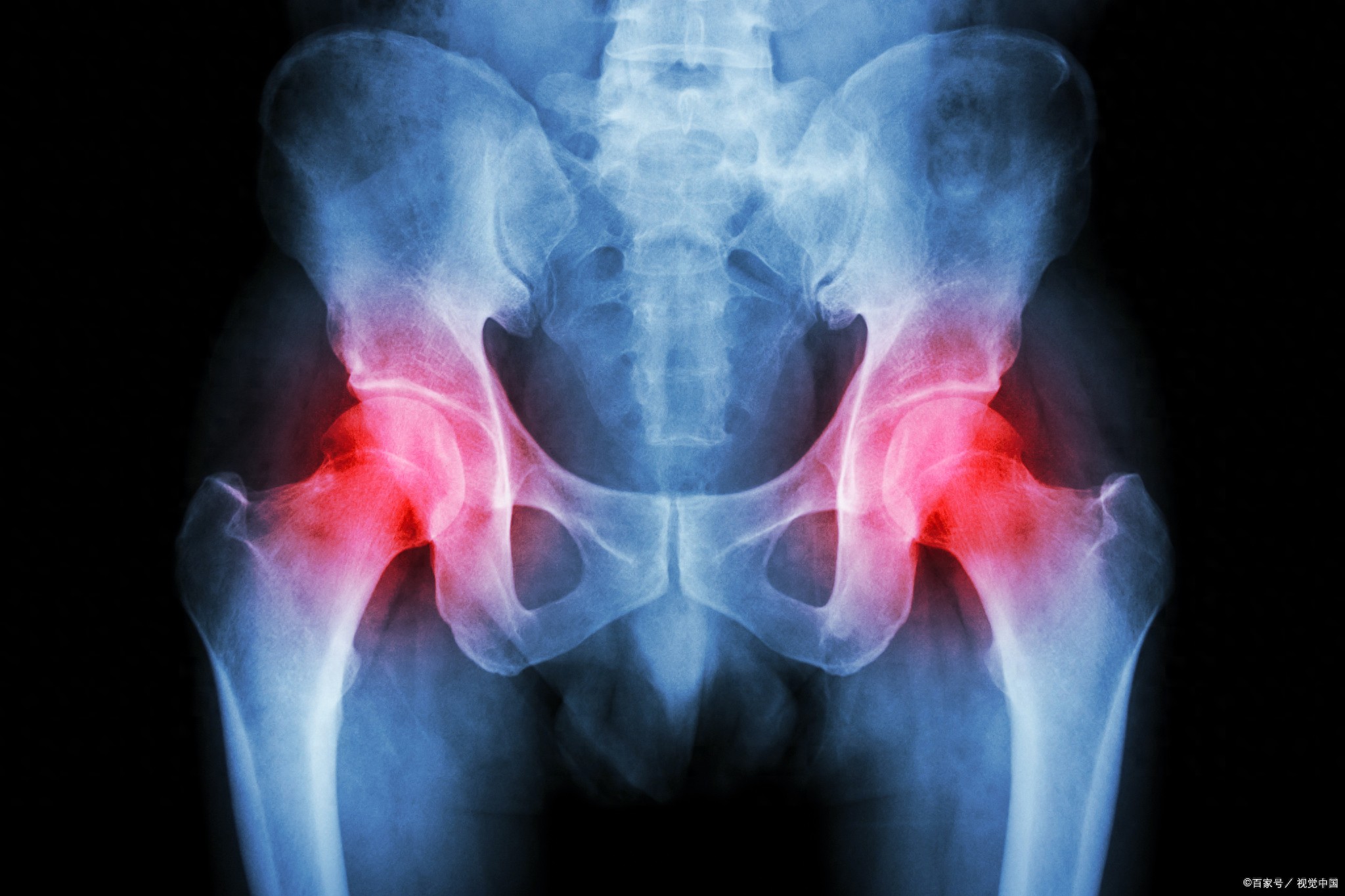 开yunapp体育官网入口下载手机版 髋关节与全身关节痛都有关，两招强化立即改善！